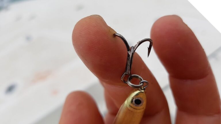 How to Remove a Fishing Hook from Your Hand